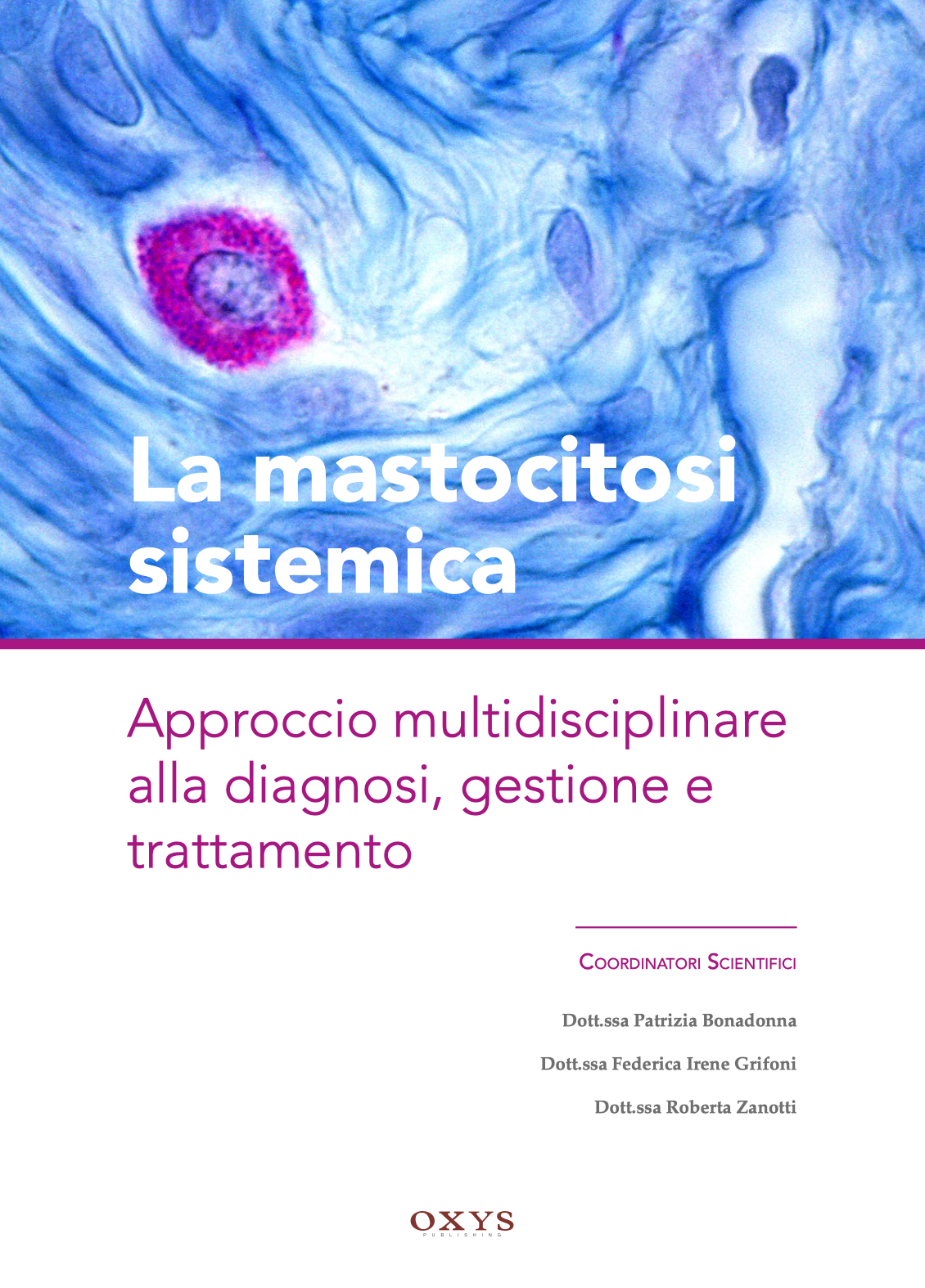La mastocitosi sistemica